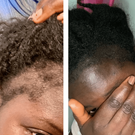 Hair Oil Mega Ayurvedic Growth